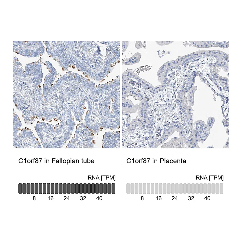 Atlas Antibodies Anti-C1orf87 Antibody