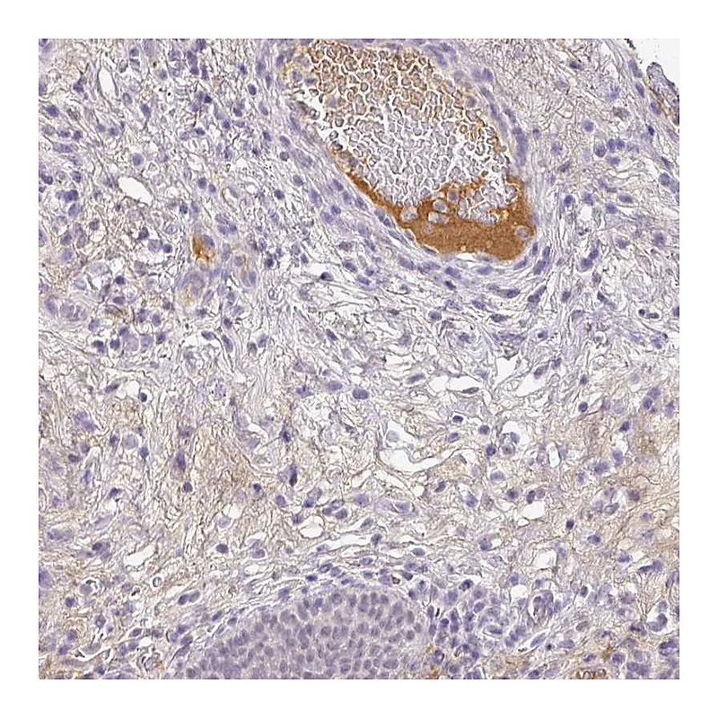 Atlas Antibodies Anti-C1QB Antibody