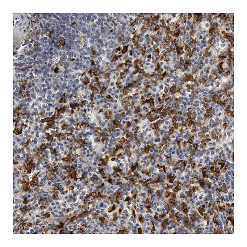 Atlas Antibodies Anti-C1QC Antibody
