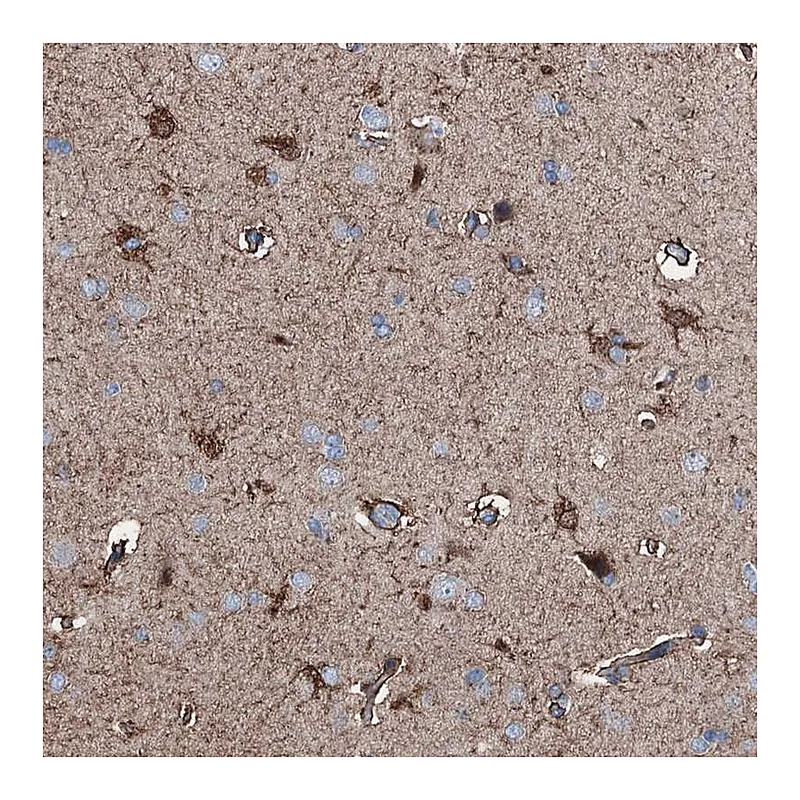Atlas Antibodies Anti-C1QTNF4 Antibody