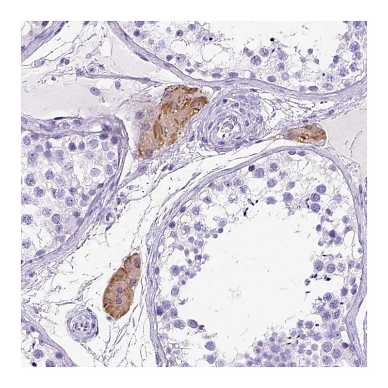 Atlas Antibodies Anti-C1QTNF3 Antibody