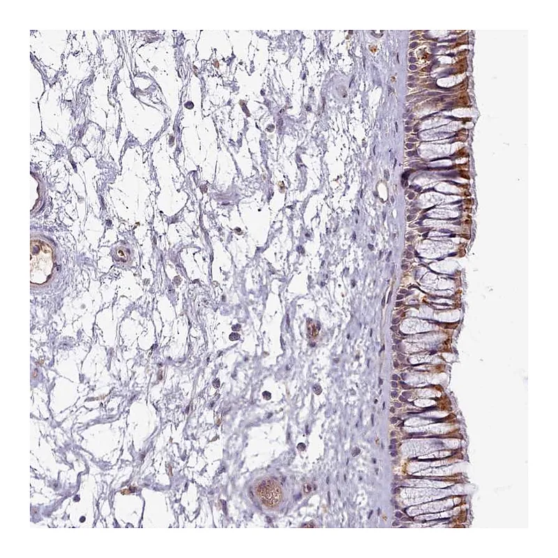 Atlas Antibodies Anti-C1QTNF5 Antibody
