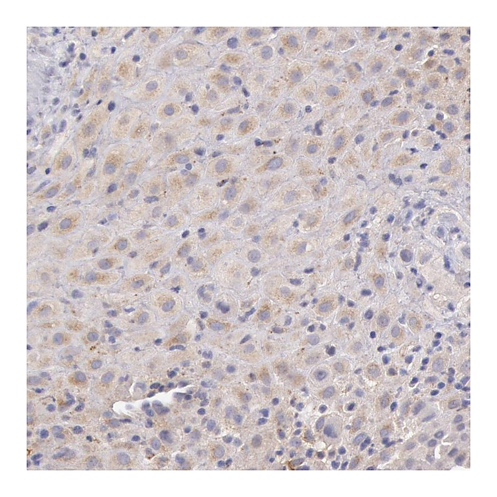 Atlas Antibodies Anti-C1R Antibody