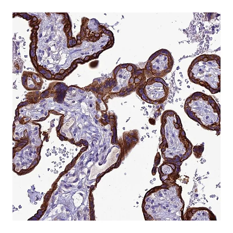 Atlas Antibodies Anti-C20orf202 Antibody