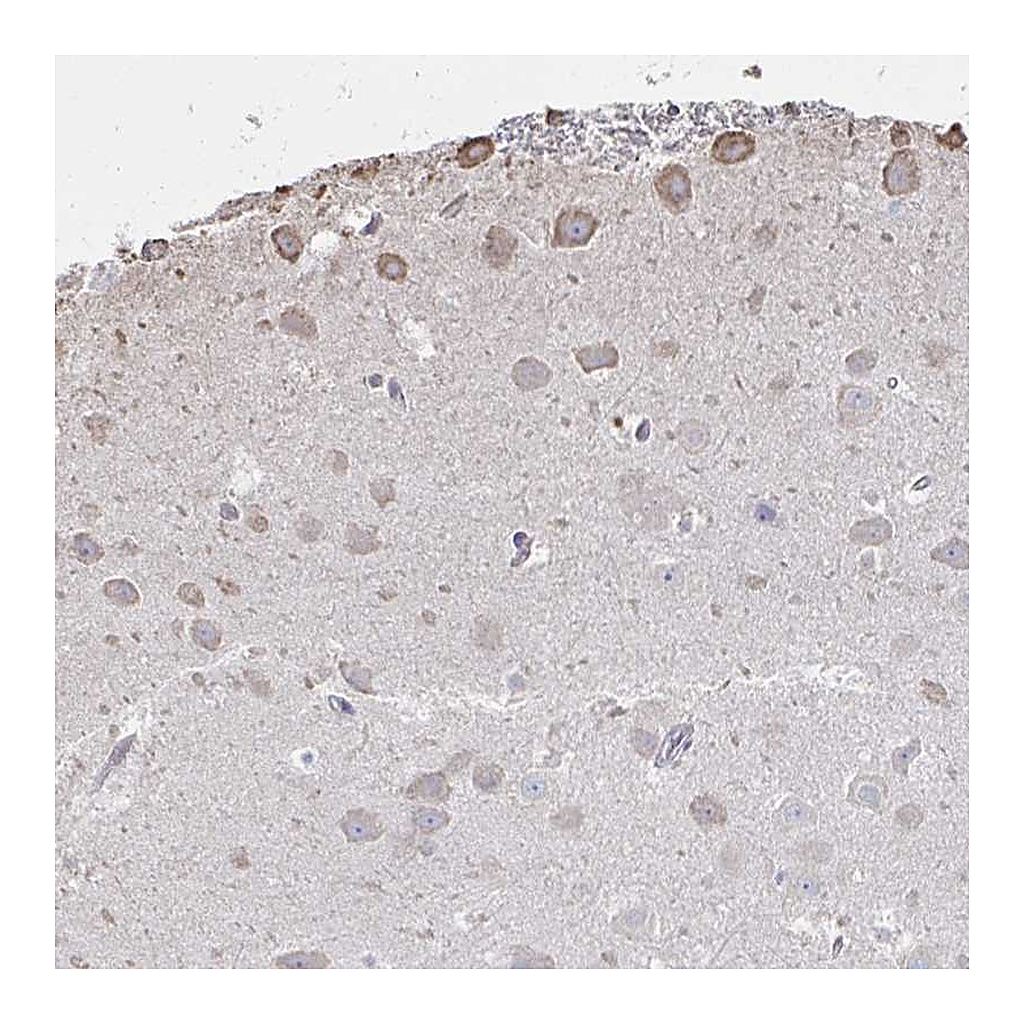 Atlas Antibodies Anti-C20orf24 Antibody