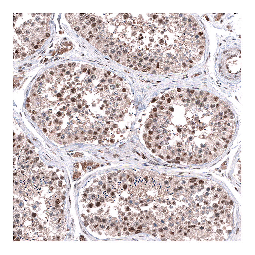 Atlas Antibodies Anti-C20orf196 Antibody