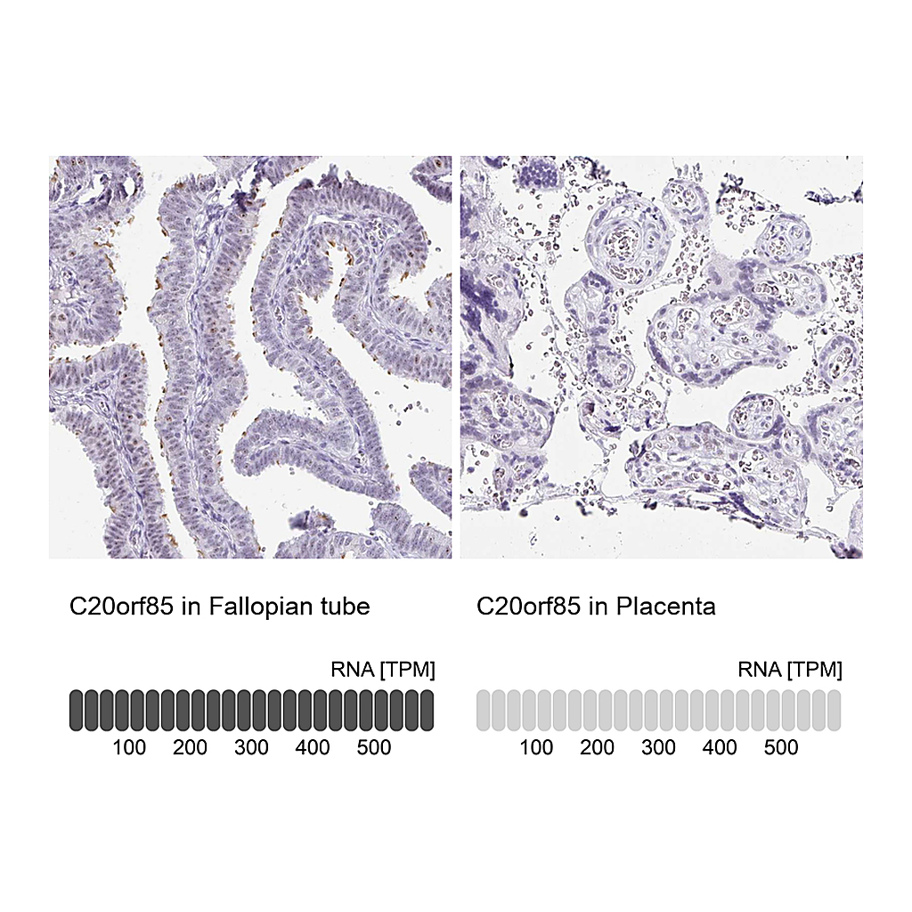 Atlas Antibodies Anti-C20orf85 Antibody
