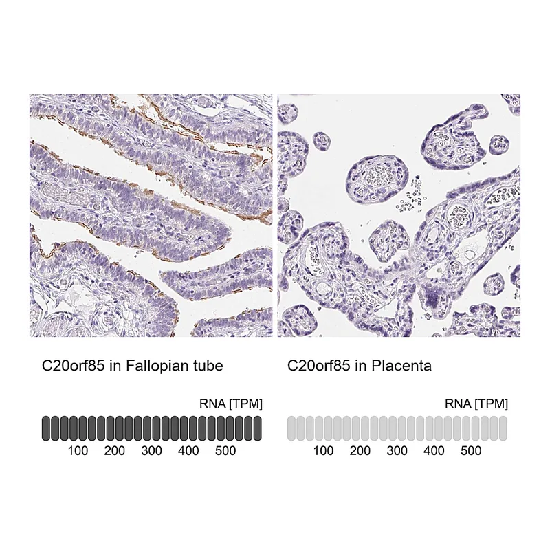 Atlas Antibodies Anti-C20orf85 Antibody
