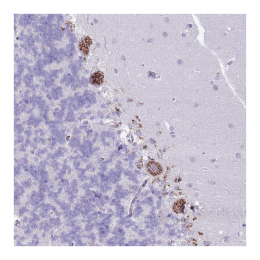 Atlas Antibodies Anti-C20orf96 Antibody