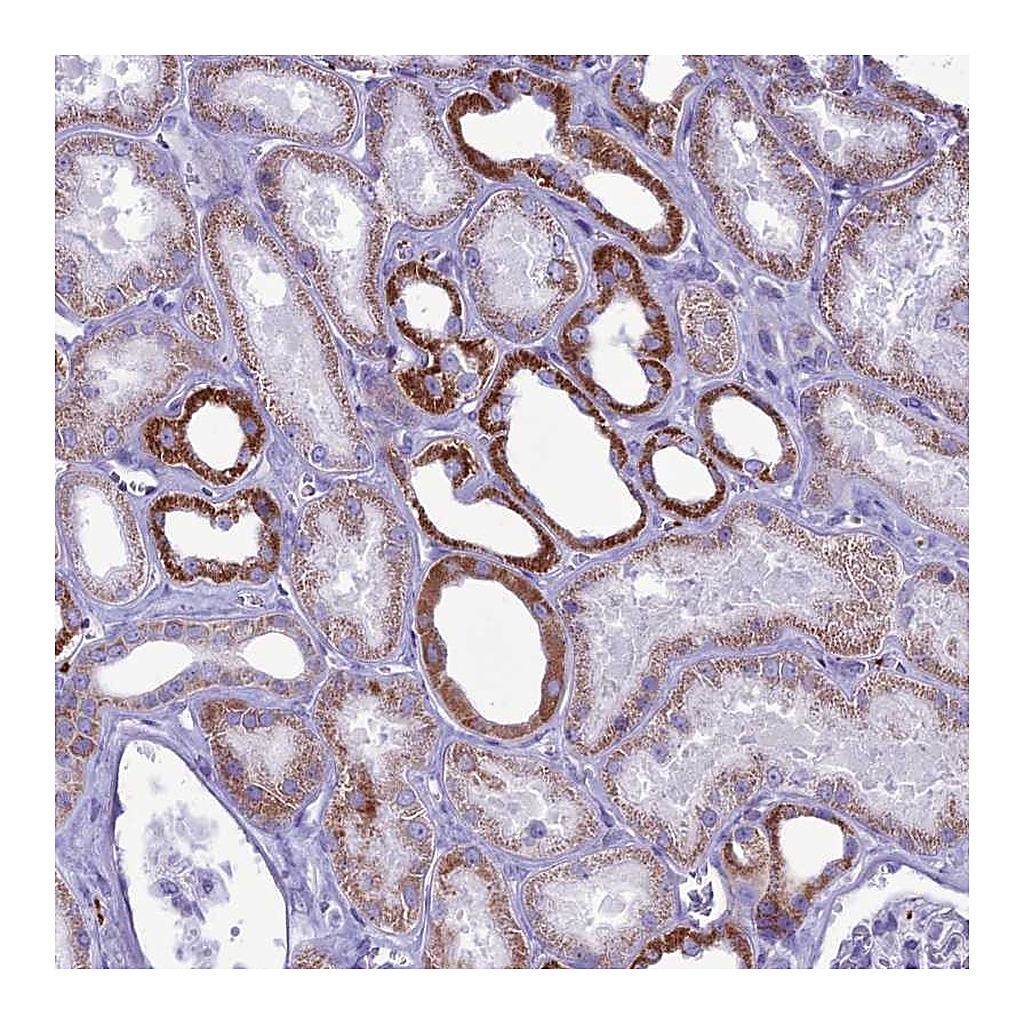 Atlas Antibodies Anti-C21orf140 Antibody