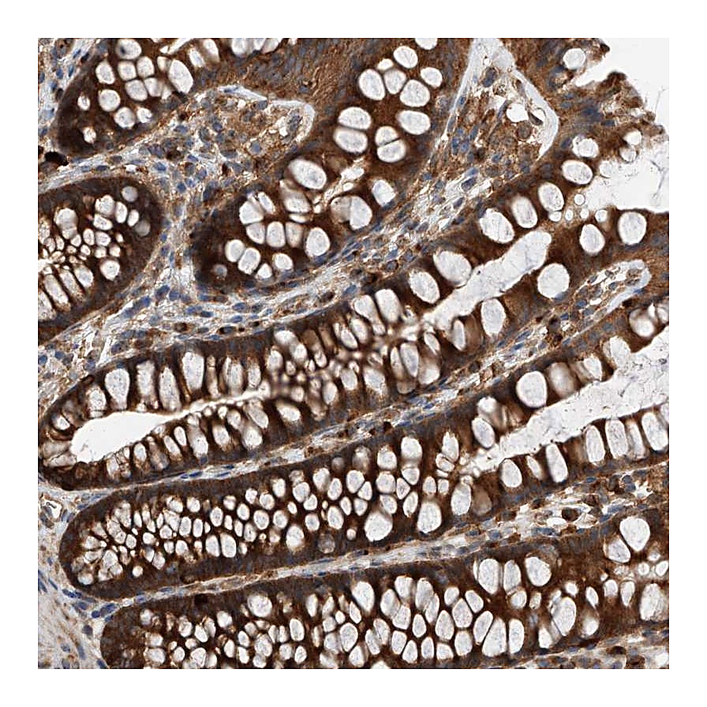 Atlas Antibodies Anti-C21orf2 Antibody