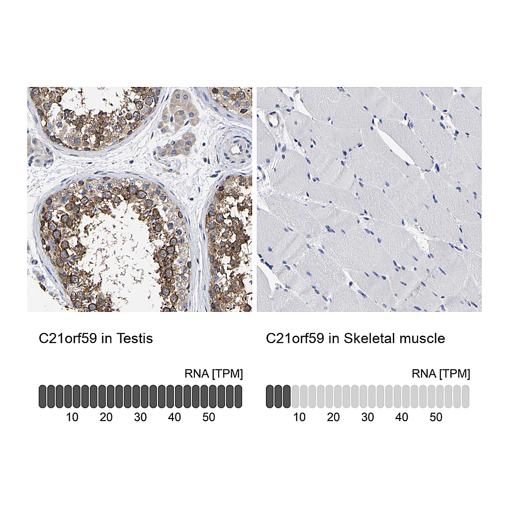 Atlas Antibodies Anti-C21orf59 Antibody