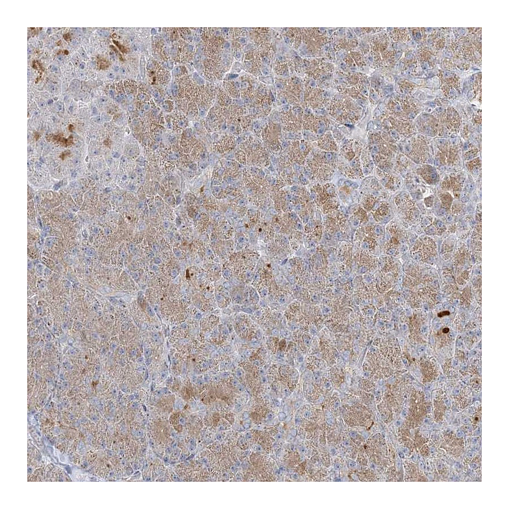 Atlas Antibodies Anti-C21orf58 Antibody