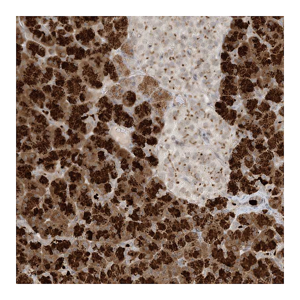 Atlas Antibodies Anti-C21orf58 Antibody