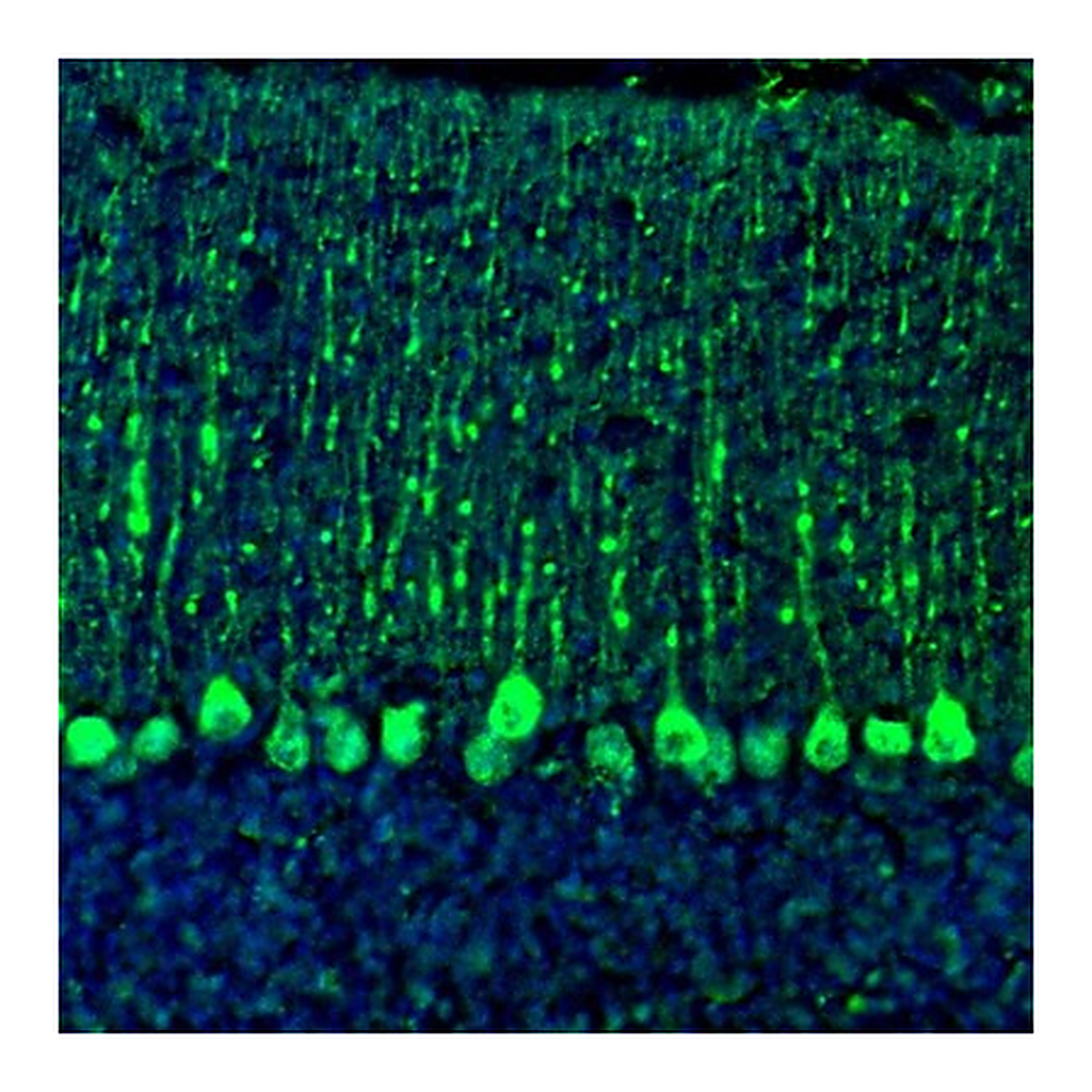 Atlas Antibodies Anti-C21orf59 Antibody
