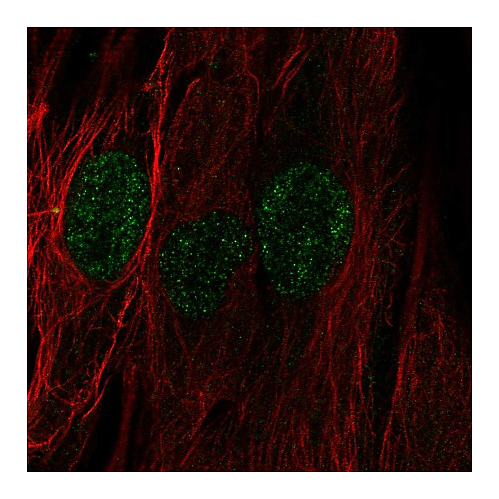 Atlas Antibodies Anti-C22orf23 Antibody