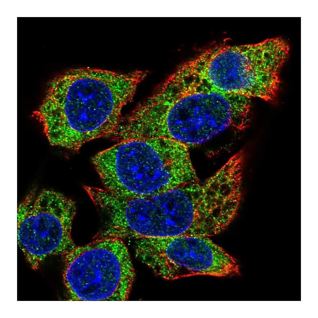Atlas Antibodies Anti-C22orf39 Antibody