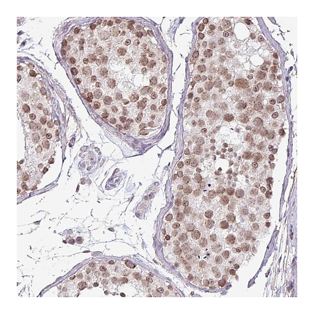 Atlas Antibodies Anti-C22orf46 Antibody