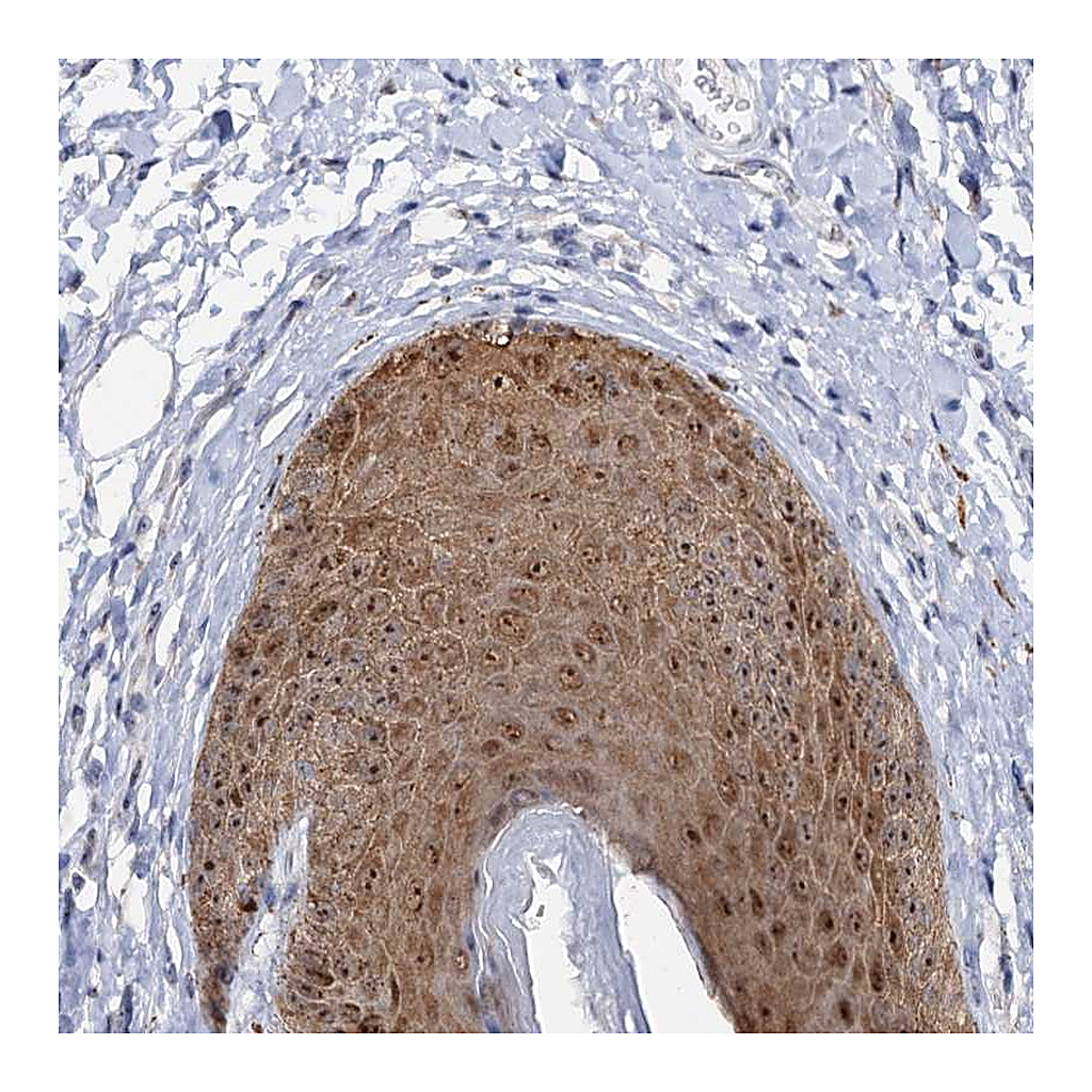 Atlas Antibodies Anti-C2CD3 Antibody