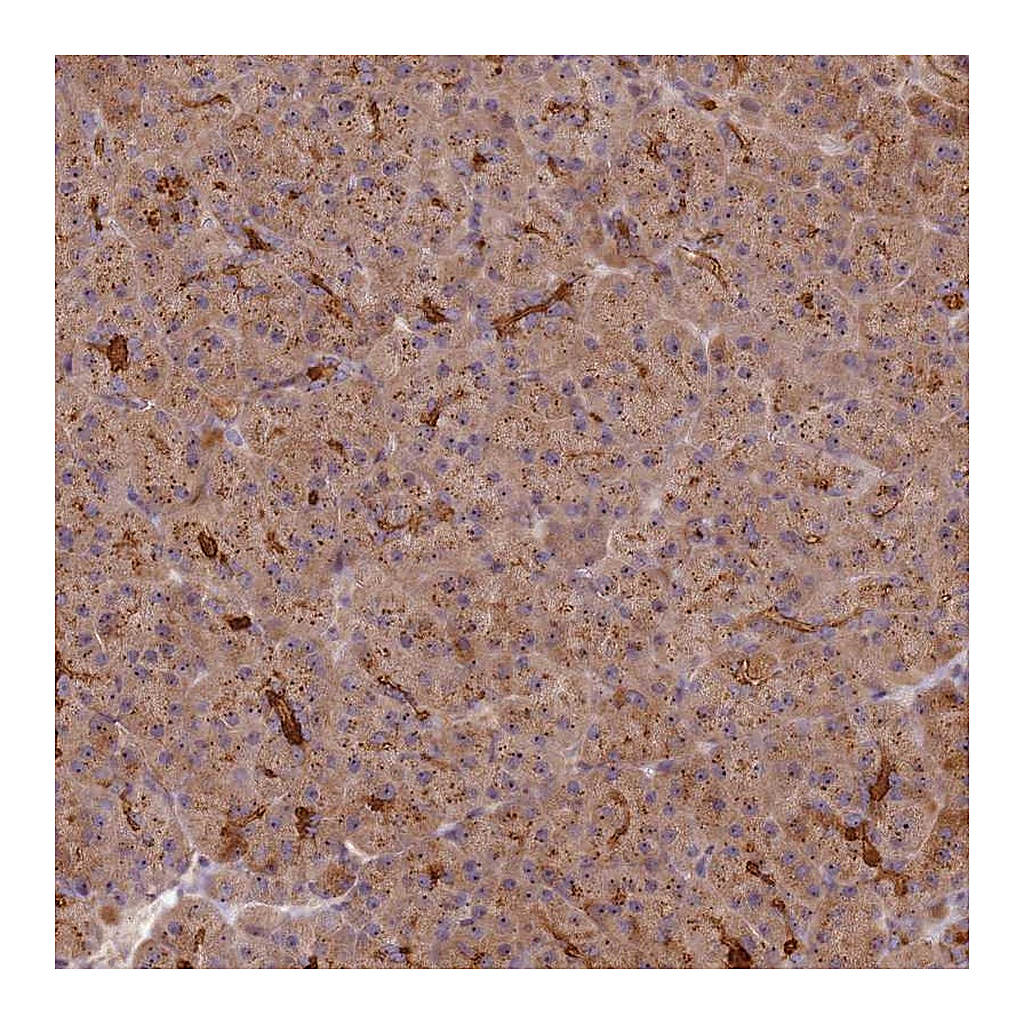 Atlas Antibodies Anti-C2CD4B Antibody