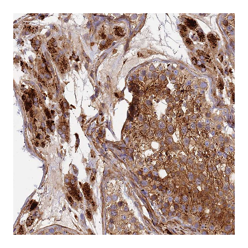 Atlas Antibodies Anti-C2CD5 Antibody