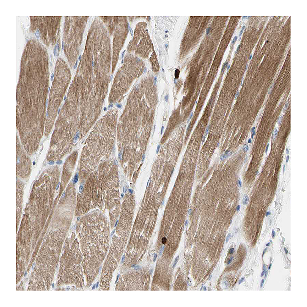 Atlas Antibodies Anti-C2orf40 Antibody