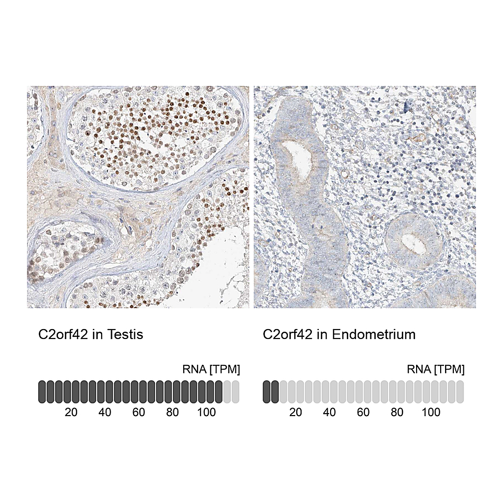 Atlas Antibodies Anti-C2orf42 Antibody