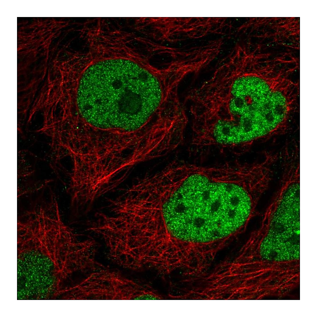 Atlas Antibodies Anti-C2orf49 Antibody
