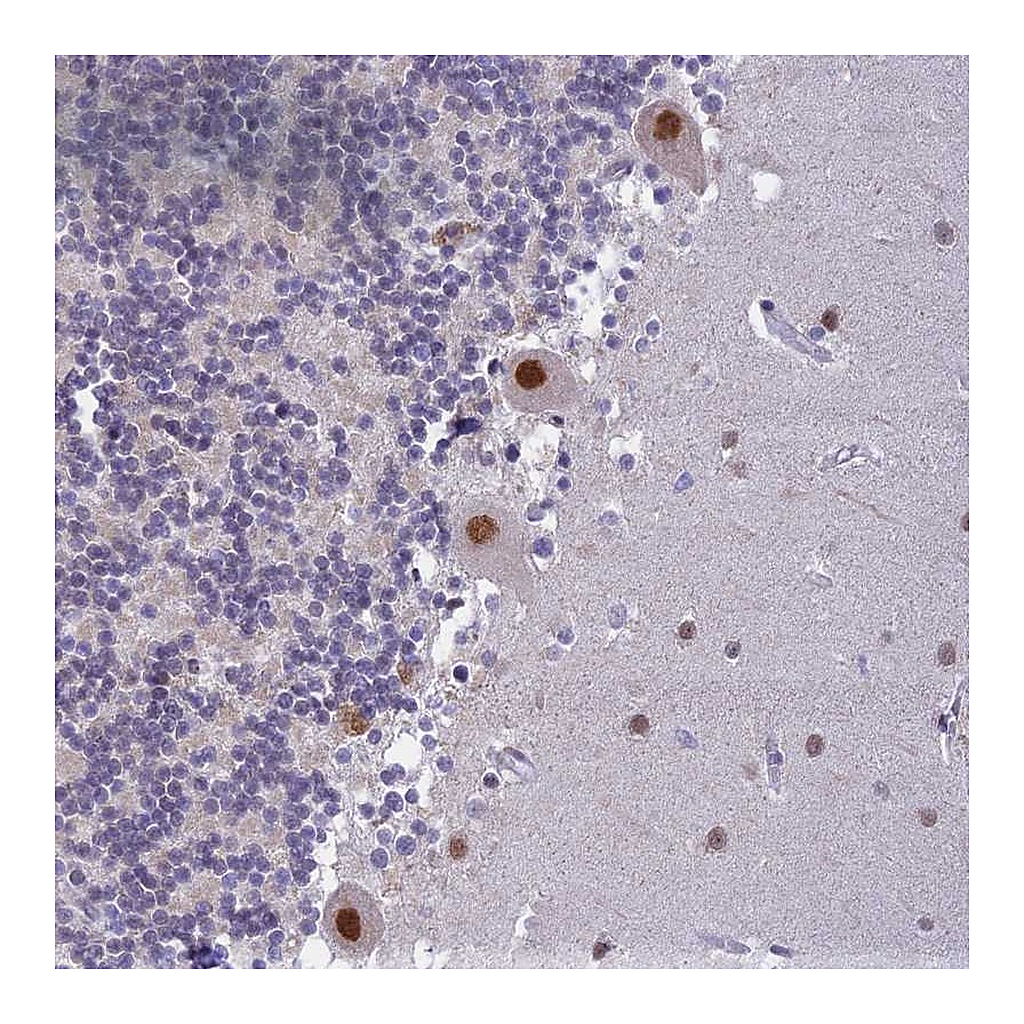 Atlas Antibodies Anti-C2orf49 Antibody