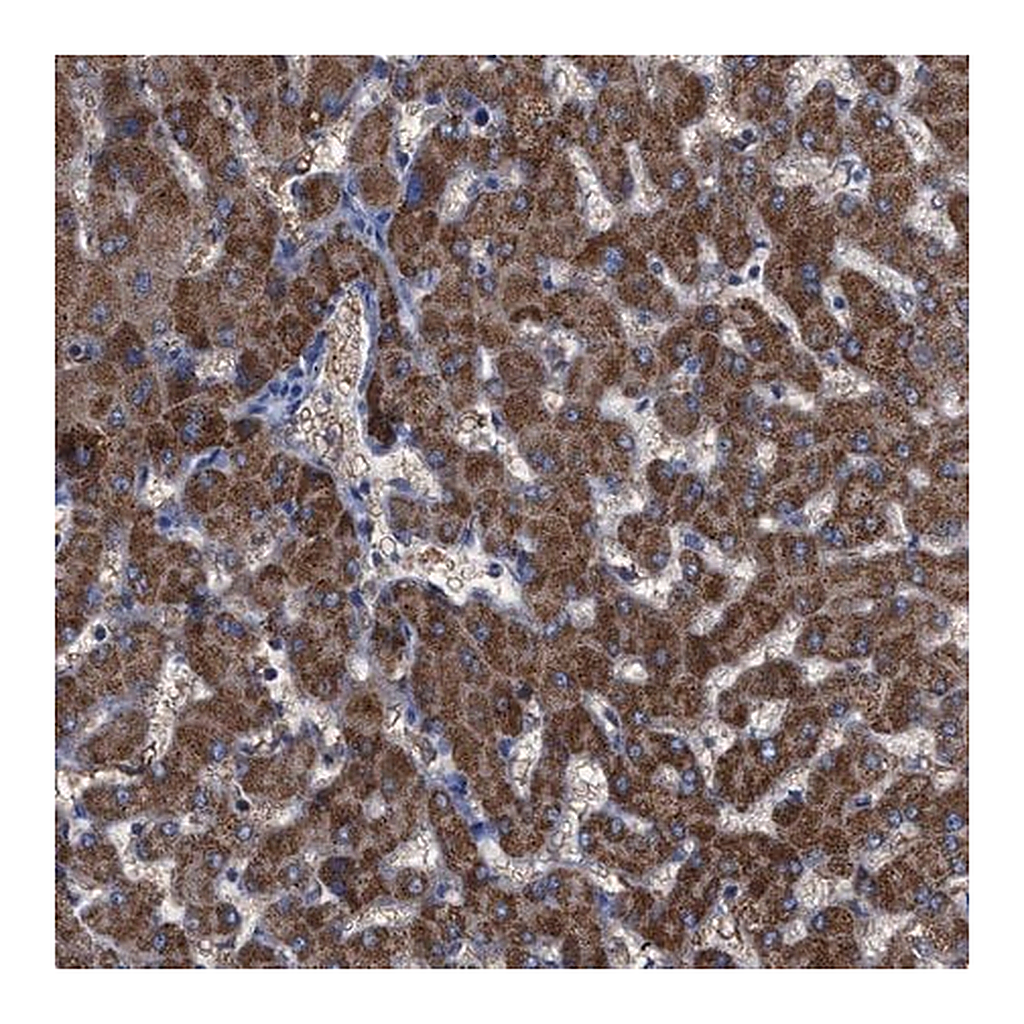 Merck Anti-GPR179 antibody produced in rabbit