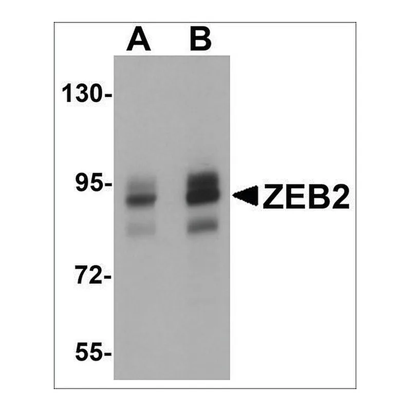 Merck Anti-ZEB2 antibody produced in rabbit