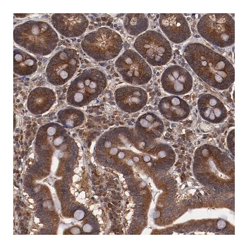 Merck Anti-TXNDC16 antibody produced in rabbit
