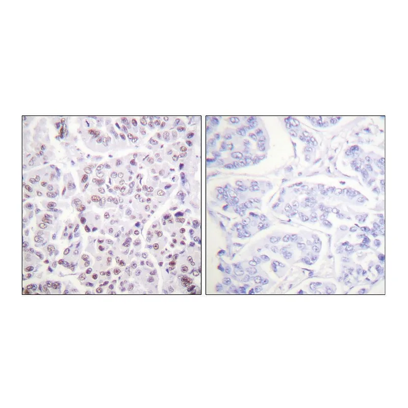 Merck Anti-Histone H4 (Acetyl-Lys5) antibody produced in rabbit