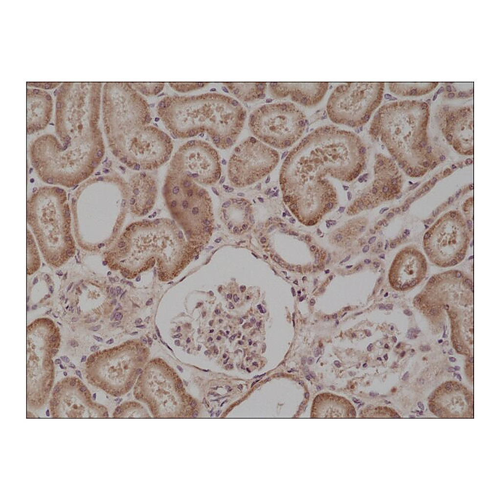 Merck Anti-BRAFantibody, Rabbit Monoclonal