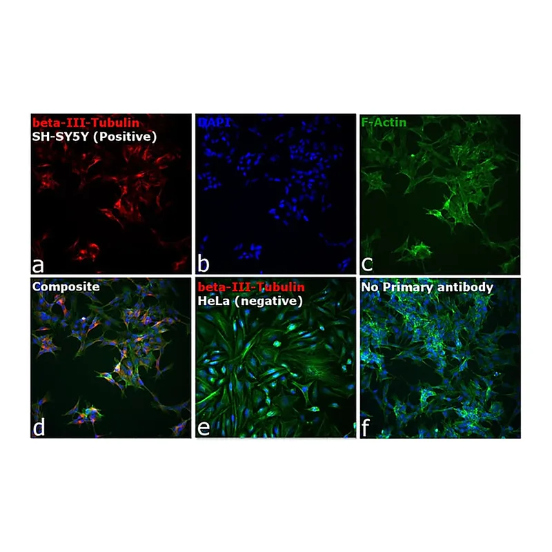 Thermo Fisher Scientific Goat anti-Mouse IgG2a Cross-Adsorbed Secondary Antibody, Alexa Fluor 594