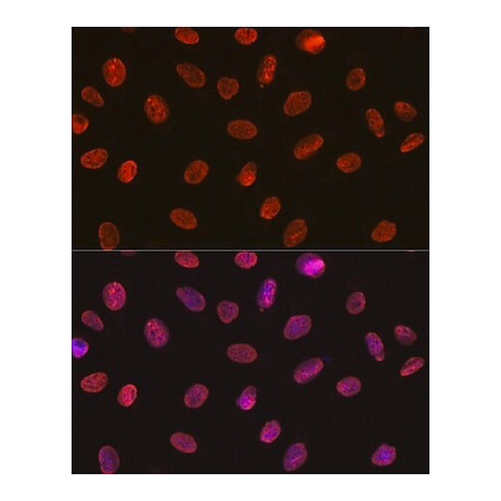 Merck Anti-U1A/SNRPA antibody produced in rabbit