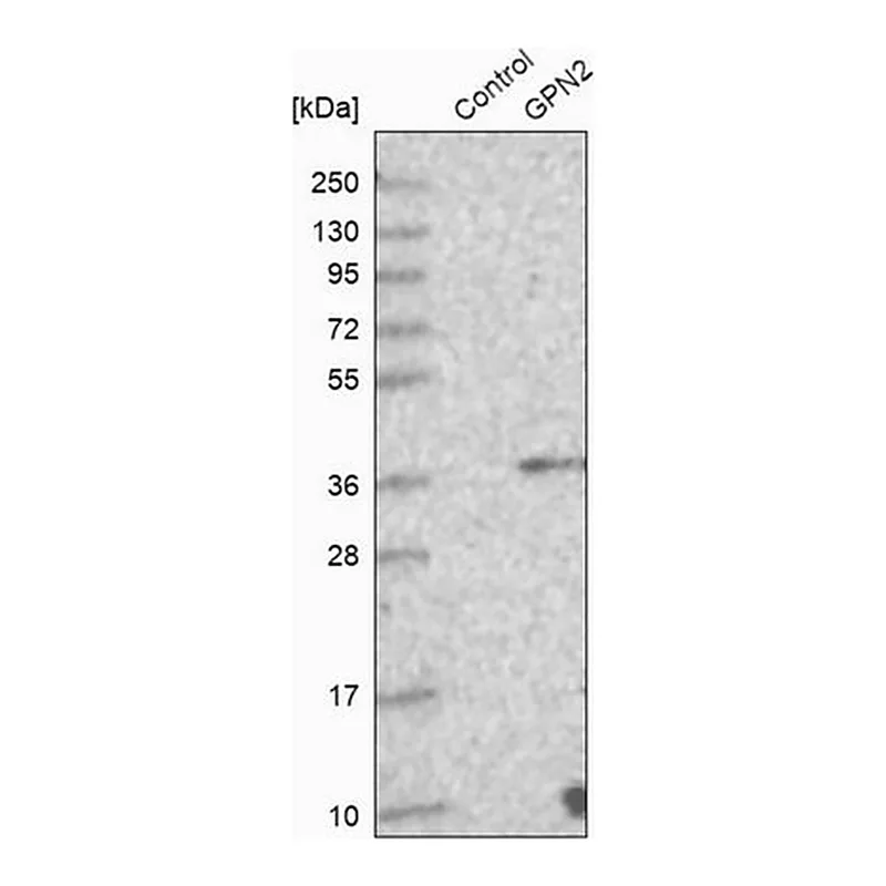 Merck ANTI-GPN2