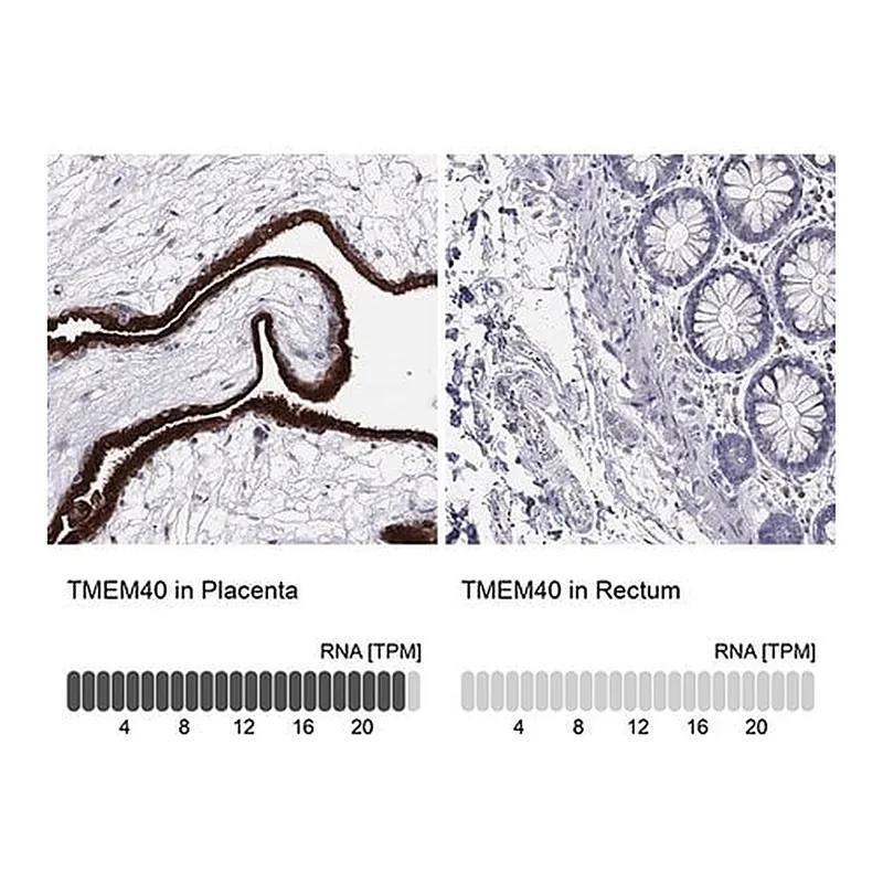 Merck Anti-TMEM40 antibody produced in rabbit
