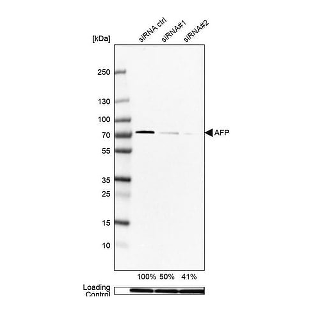 Merck Anti-AFP antibody produced in rabbit