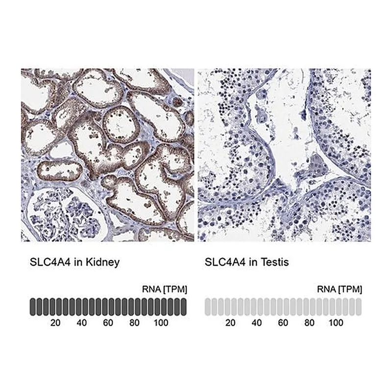 Merck Anti-SLC4A4 antibody produced in rabbit