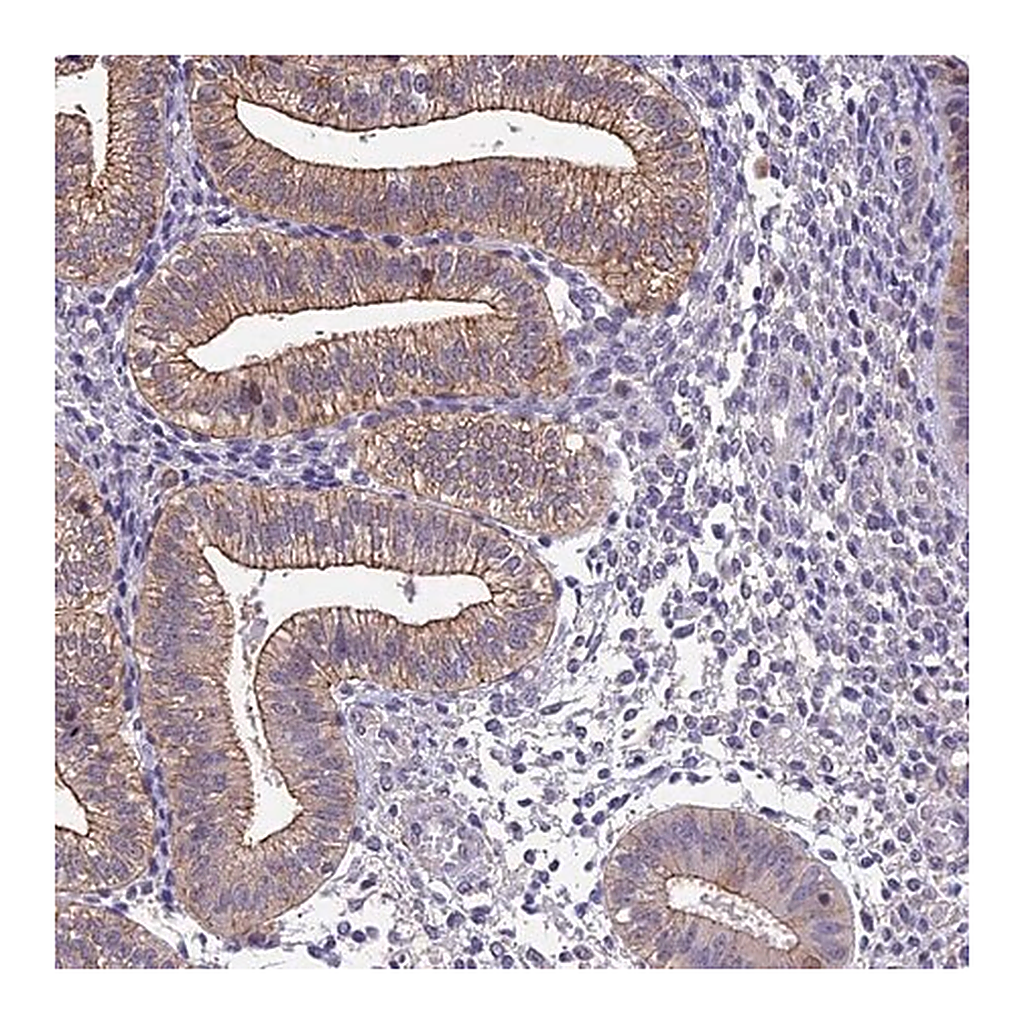 Merck Anti-BSPRY antibody produced in rabbit