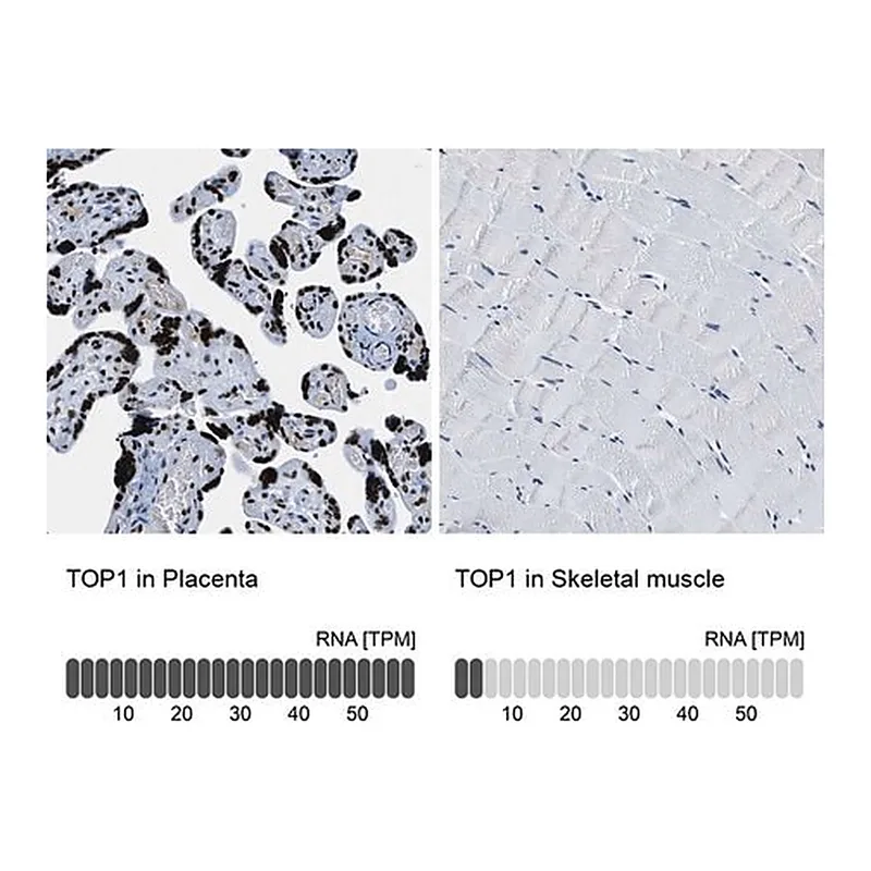 Merck Anti-TOP1 antibody produced in rabbit