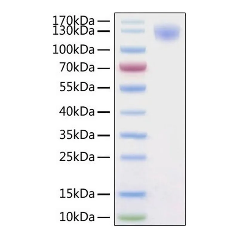 Merck Recombinant 2019-nCoV Spike S1 Protein with His tag