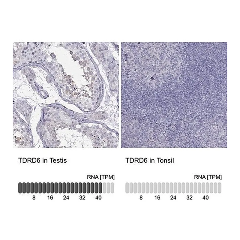 Merck Anti-TDRD6 antibody produced in rabbit