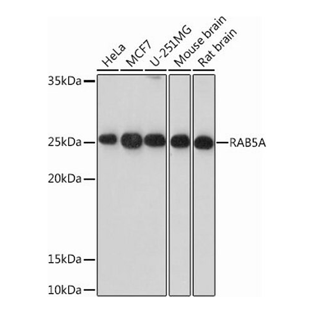 Merck Anti-RAB5A antibody produced in rabbit