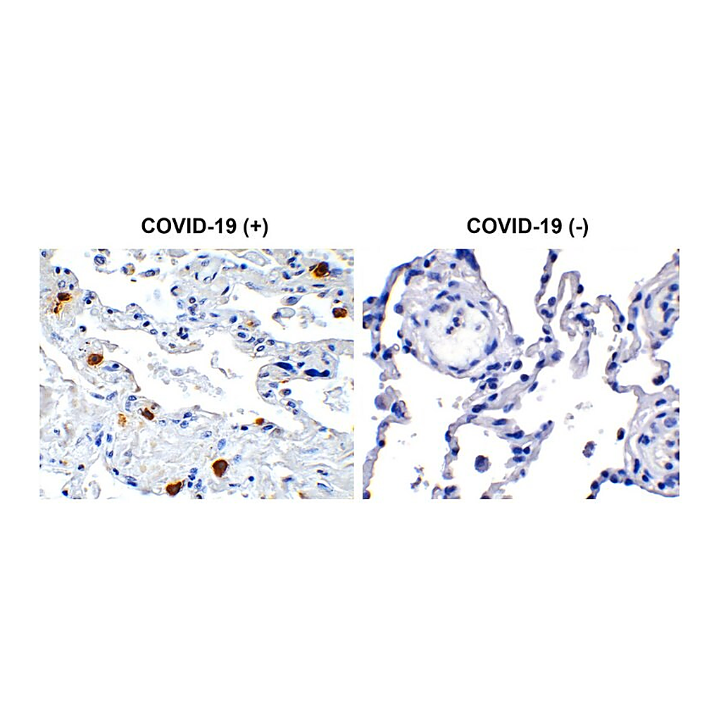 Merck Anti-SARS-CoV-2 (COVID-19) NSP8 antibody produced in rabbit