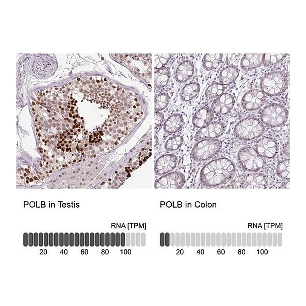 Merck Anti-POLB antibody produced in rabbit