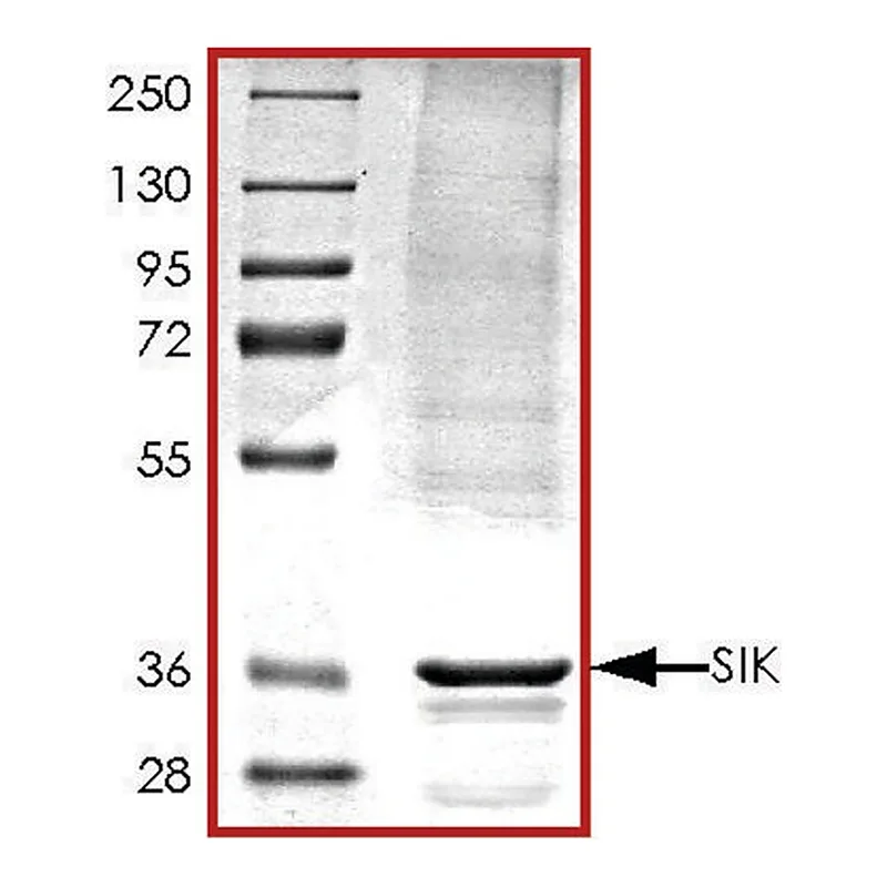Merck SIK (1-303), active, His tagged human
