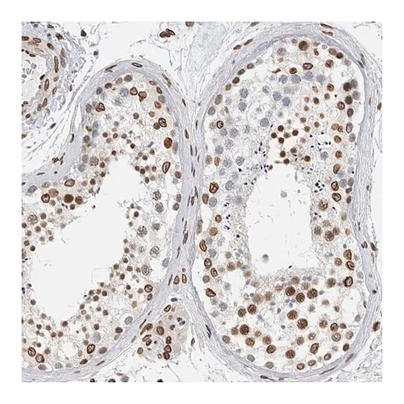 Merck Anti-CDCA2 antibody produced in rabbit