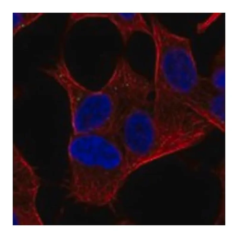 Merck Anti-ZCCHC18 antibody produced in rabbit